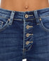 Close-up of blue denim shorts with button details on a blurred background