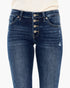 Close-up of a person wearing dark blue distressed denim jeans with a high waist and five front buttons, paired with a light cream top against a plain white background.